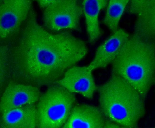 Anti-ATP citrate lyase/ACLY Antibody (8R855)
