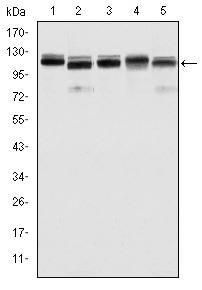 Anti-BMPR2 Antibody (9I236)