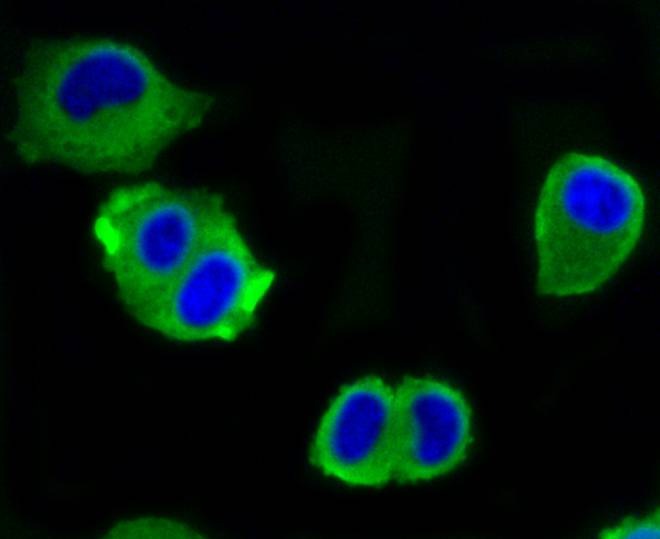 Anti-ATP citrate lyase/ACLY Antibody (8R855)