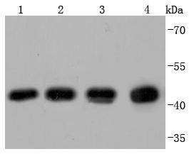 Anti-Beta-Actin Antibody-HRP (4B231)