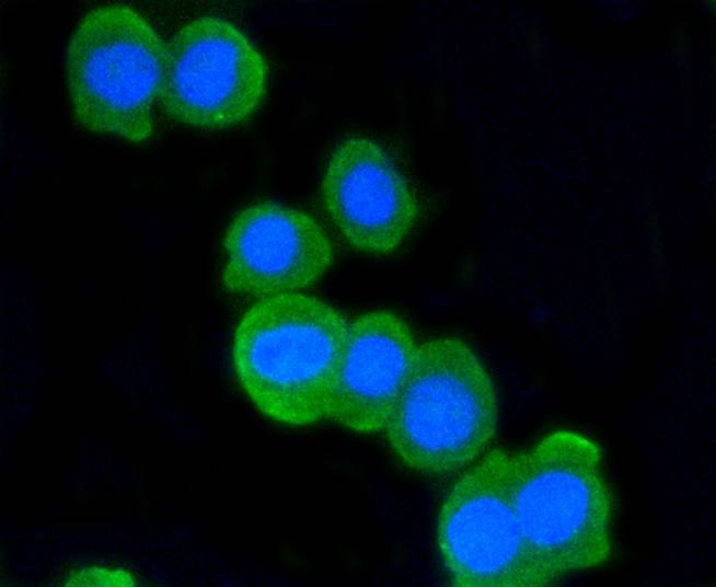 Anti-ATM Antibody (9B624)