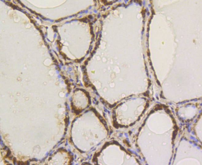 Anti-ATP citrate lyase/ACLY Antibody (8R855)