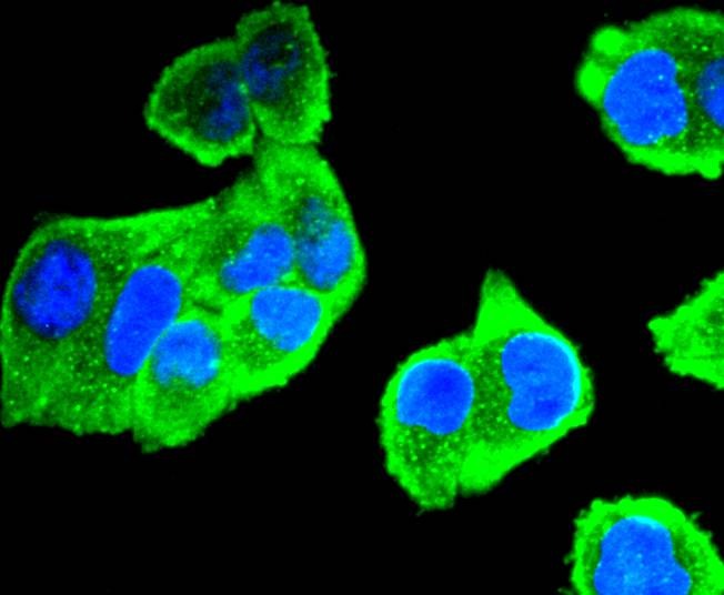 Anti-AURKA Antibody (1Y815)