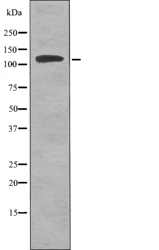 Anti-Phospho-ATP1A1 (Tyr260) Polyclonal Antibody 2