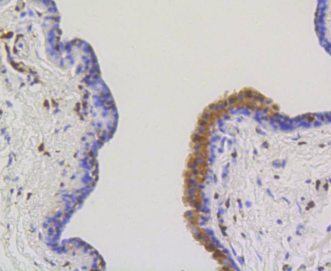 Anti-ATP citrate lyase/ACLY Antibody (8R855)