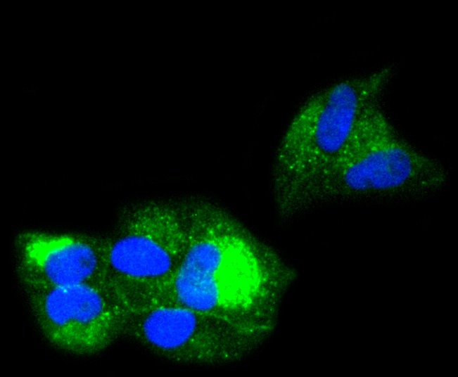 Anti-B2M/beta 2-Microglobulin Antibody (1O957)