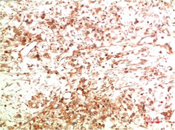 Anti-ATG5 Antibody (3S196)
