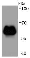 Anti-ADRB2 Antibody (3B949)