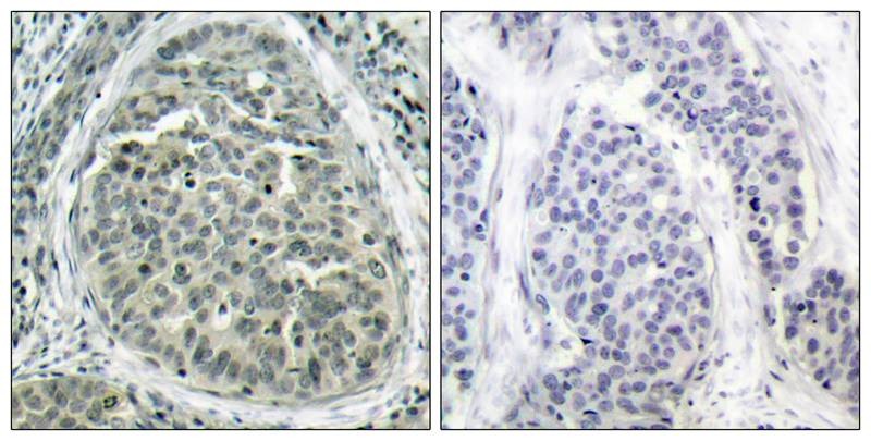 Anti-Phospho-CTNNB1 (Ser37) Polyclonal Antibody 2