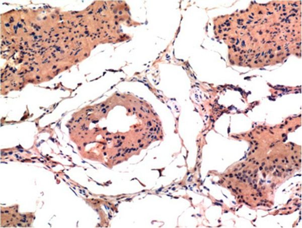 Anti-BAX Antibody (6T681)