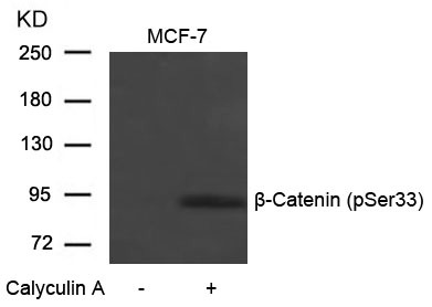 Anti-Phospho-CTNNB1 (Ser33) Polyclonal Antibody 2