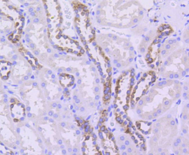 Anti-beta Ⅱ Tubulin  Antibody (5R171)