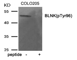 Anti-Phospho-BLNK (Tyr96) Polyclonal Antibody