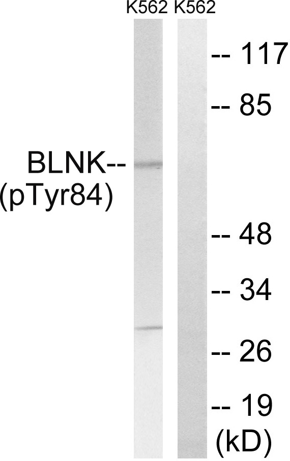 Anti-Phospho-BLNK (Tyr84) Polyclonal Antibody