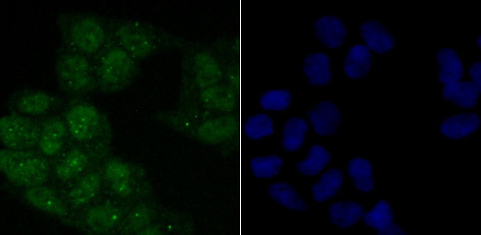 Anti-Phospho-ATM (Ser1981) Antibody (4B419)