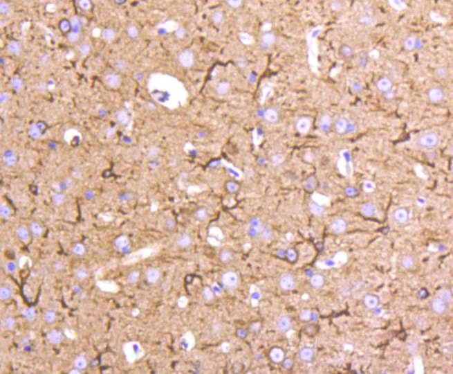 Anti-beta Ⅱ Tubulin  Antibody (5R171)