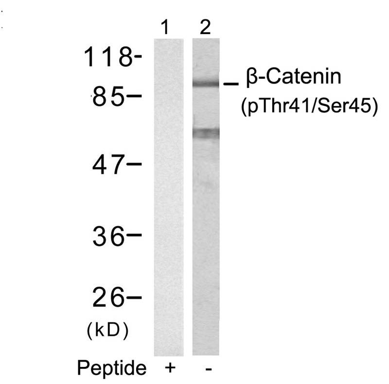 Anti-Phospho-CTNNB1 (Thr41, Ser45) Polyclonal Antibody