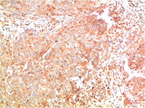Anti-ATG7 Antibody (5A794)