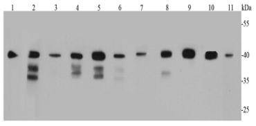 Anti-BMI-1 Antibody (8M743)