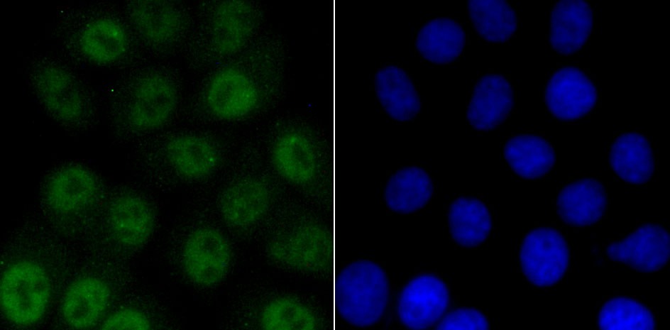 Anti-Phospho-ATM (Ser1981) Antibody (4B419)