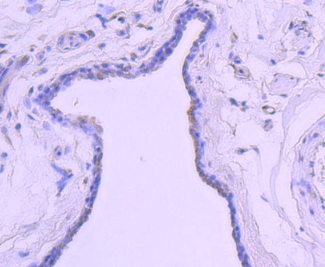Anti-Androgen receptor Antibody (3T582)