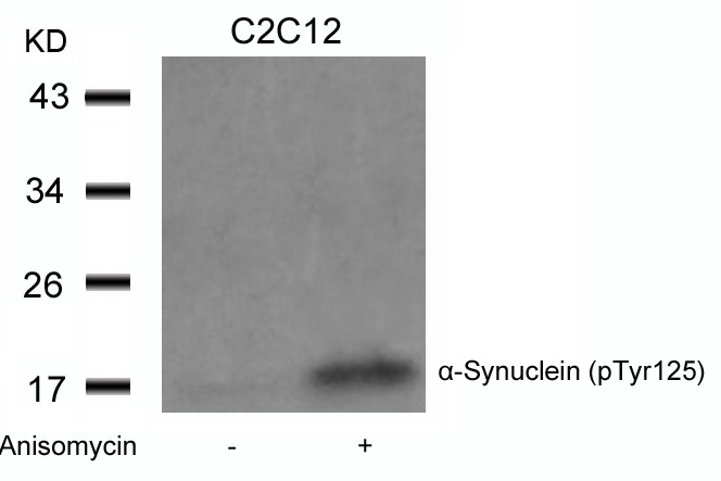 Anti-Phospho-Alpha-Synuclein (Tyr125) Polyclonal Antibody
