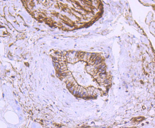 Anti-ACTA2 Antibody (1S368)