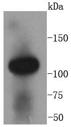 Anti-ACE2/ACEH Antibody (3P140)