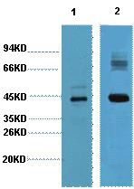 Anti-AMACR Antibody (7V845)
