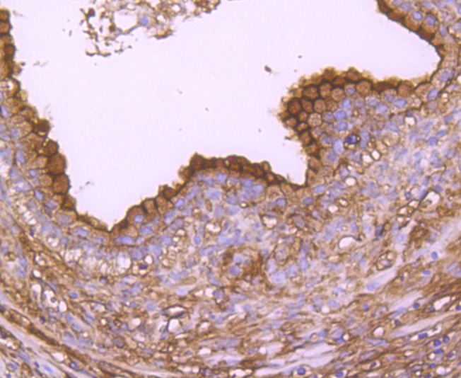 Anti-ANXA2 Antibody (4Q629)