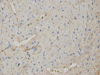 Anti-ACTA2 Antibody (1X82)