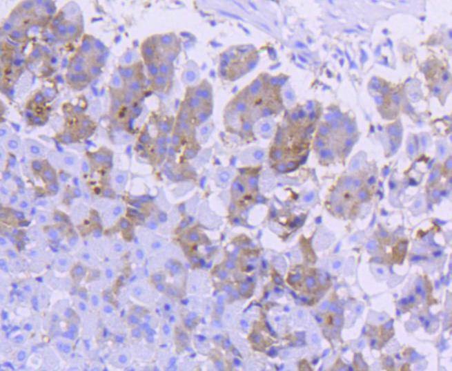 Anti-Asparagine synthetase Antibody (3D193)