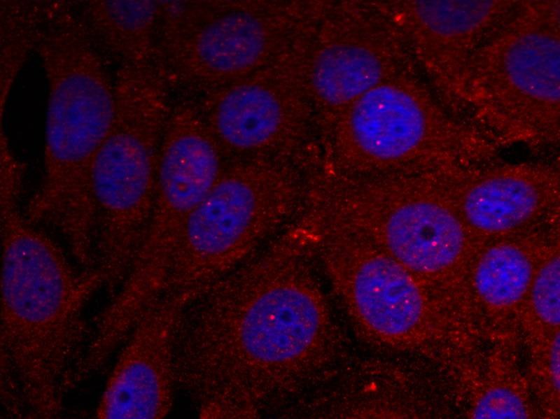 Anti-Phospho-Alpha-Synuclein (Tyr136) Polyclonal Antibody