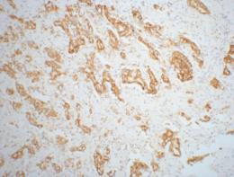 Anti-AMACR Antibody (7V845)