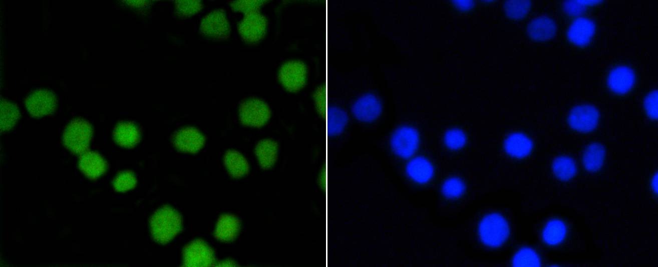 Anti-ASH2L Antibody (4J278)