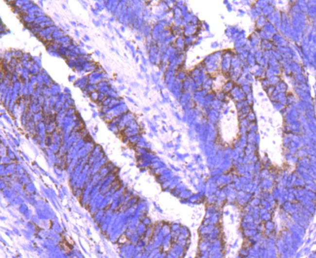 Anti-ANGPT2/Angiopoietin-2 Antibody (6W480)