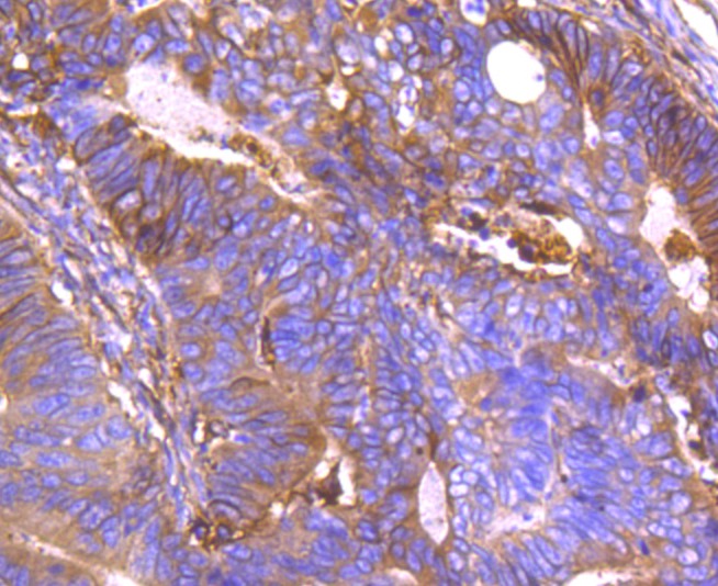 Anti-ANXA2 Antibody (4Q629)