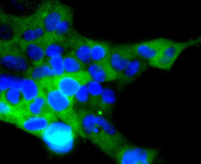 Anti-ACE2/ACEH Antibody (3P140)