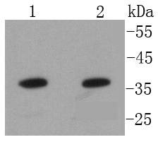 Anti-ANXA10 Antibody (4N529)