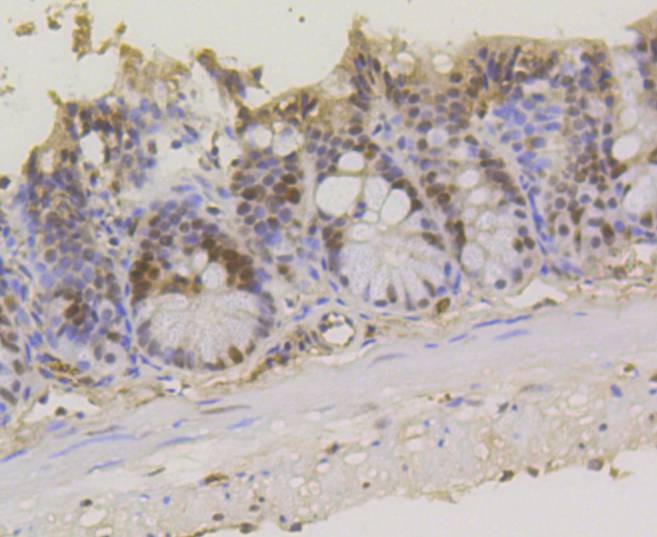 Anti-ASH2L Antibody (4J278)
