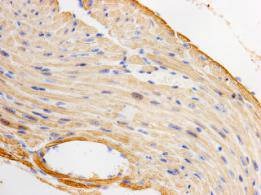 Anti-ACTC Antibody (8M810)