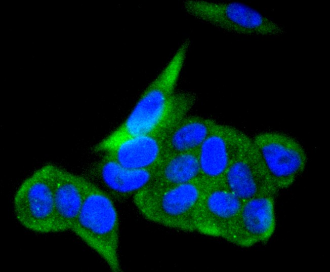Anti-ACE2/ACEH Antibody (3P140)
