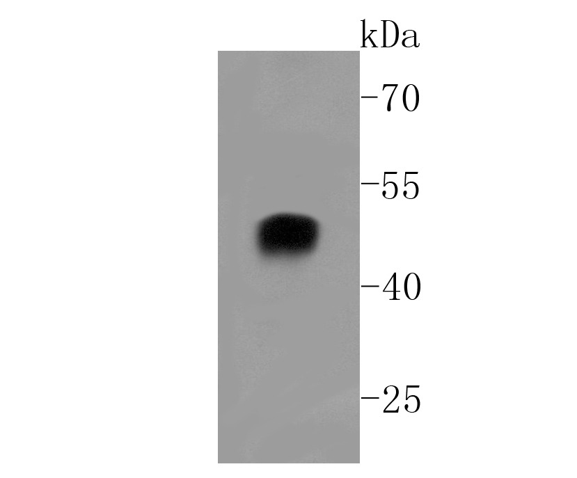 Anti-alpha sarcoglycan Antibody (1V177)