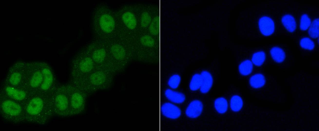 Anti-ASH2L Antibody (4J278)