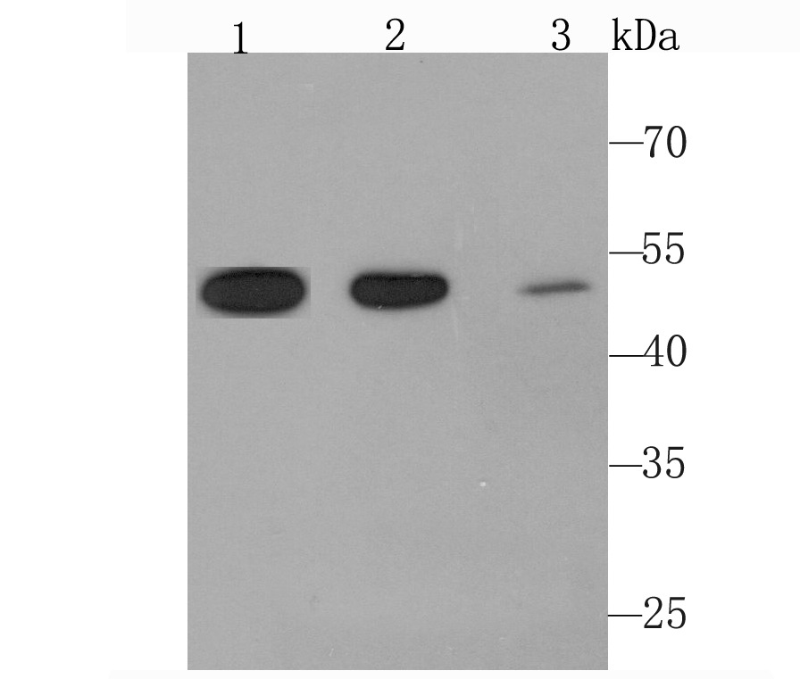 Anti-ANGPT2/Angiopoietin-2 Antibody (6W480)