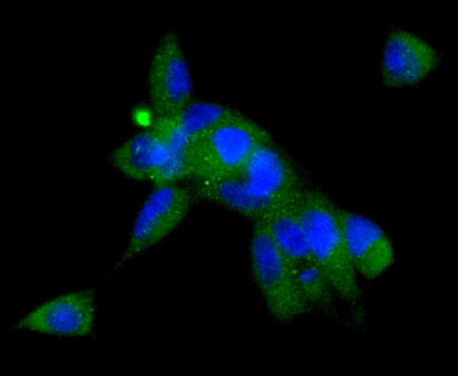 Anti-AGT Antibody (1Z261)
