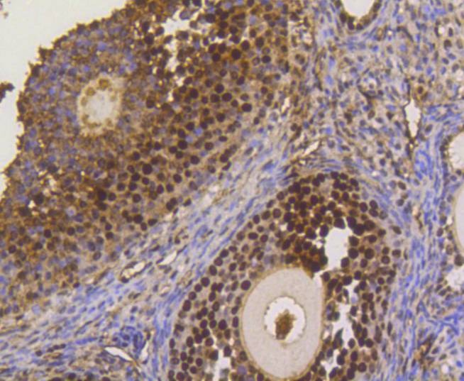 Anti-ASH2L Antibody (4J278)
