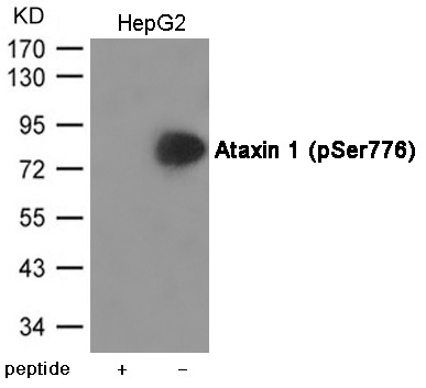 Anti-Phospho-Ataxin 1 (Ser776) Polyclonal Antibody