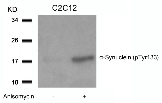 Anti-Phospho-Alpha-Synuclein (Tyr133) Polyclonal Antibody