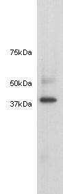 Anti-ACTC Antibody (8M810)